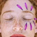 Trattamenti per lentiggini ed efelidi: ecco i migliori